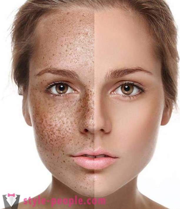 Hvordan at blege din hud derhjemme?