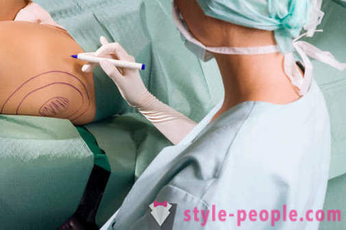 Plastikkirurger ødelægge stereotyper om deres arbejde