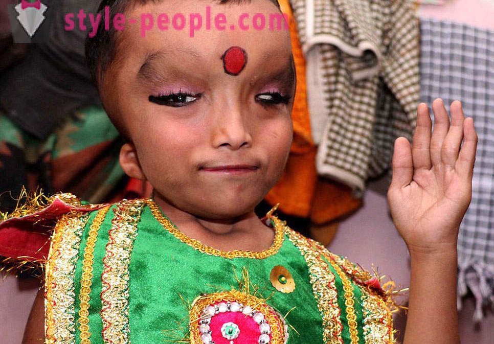 Den indiske landsby er tilbedt dreng med et deformeret hoved som en gud Ganesha