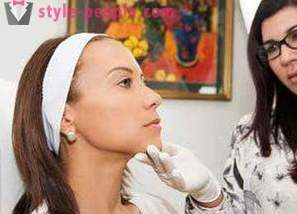 Peeling facial calciumchlorid: anmeldelser