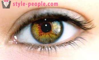 Swamp øjenfarve. Hvad bestemmer farven på det menneskelige øje?